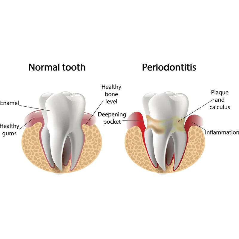 teeth diagram
